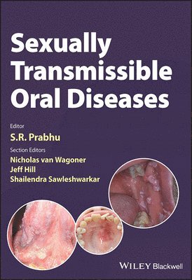 Sexually Transmissible Oral Diseases 1