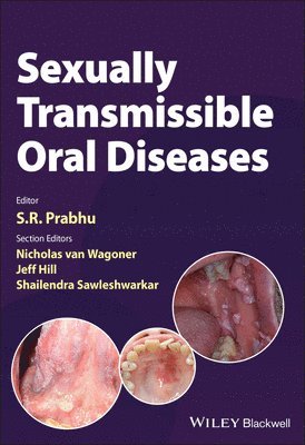 Sexually Transmissible Oral Diseases 1