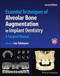 bokomslag Essential Techniques of Alveolar Bone Augmentation in Implant Dentistry