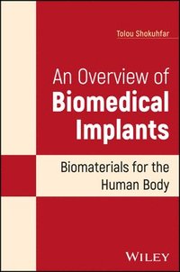 bokomslag An Overview of Biomedical Implants