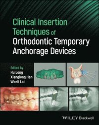 bokomslag Clinical Insertion Techniques of Orthodontic Temporary Anchorage Devices