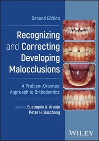 bokomslag Recognizing and Correcting Developing Malocclusions