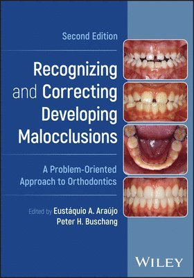 Recognizing and Correcting Developing Malocclusions 1