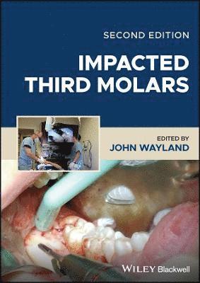 bokomslag Impacted Third Molars