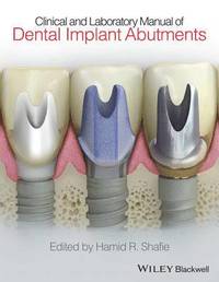 bokomslag Clinical and Laboratory Manual of Dental Implant Abutments