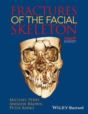 bokomslag Fractures of the Facial Skeleton