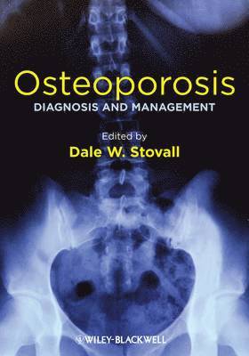 Dale W. Stovall - Osteoporosis, Inbunden