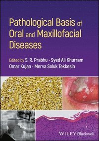 bokomslag Pathological Basis of Oral and Maxillofacial Diseases