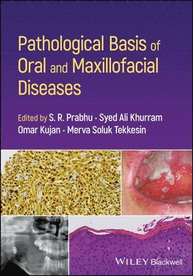 Pathological Basis of Oral and Maxillofacial Diseases 1