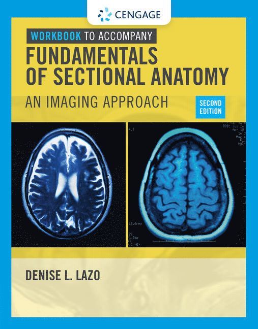 Denise Lazo, RI) Lazo, Denise (Community College of Rhode Island, Jamestown - Workbook for Lazo's Fundamentals of Sectional Anatomy: An Imaging Approach, 2nd, Häftad