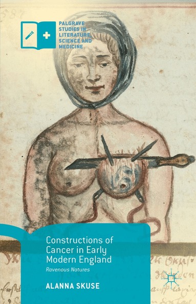Alanna Skuse - Constructions of Cancer in Early Modern England, Inbunden