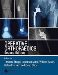 bokomslag Operative Orthopaedics