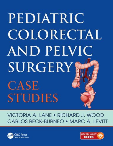 Victoria Lane, Richard Wood, Carlos Reck, Marc Levitt - Pediatric Colorectal and Pelvic Surgery, Häftad