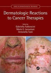 bokomslag Dermatologic Reactions to Cancer Therapies