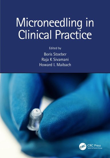 Boris Stoeber, Raja K. Sivamani, Howard Maibach - Microneedling in Clinical Practice, Häftad