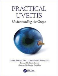 bokomslag Practical Uveitis