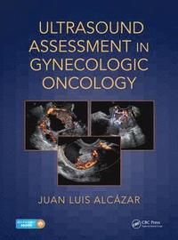 bokomslag Ultrasound Assessment in Gynecologic Oncology