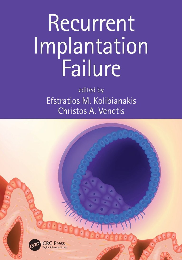 Efstratios M. Kolibianakis, Christos A. Venetis - Recurrent Implantation Failure, Inbunden