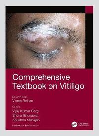 bokomslag Comprehensive Textbook on Vitiligo