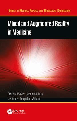 Terry M. Peters, Cristian A. Linte, Ziv Yaniv, Jacqueline Williams - Mixed and Augmented Reality in Medicine, Inbunden