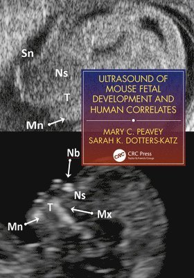 Ultrasound of Mouse Fetal Development and Human Correlates 1