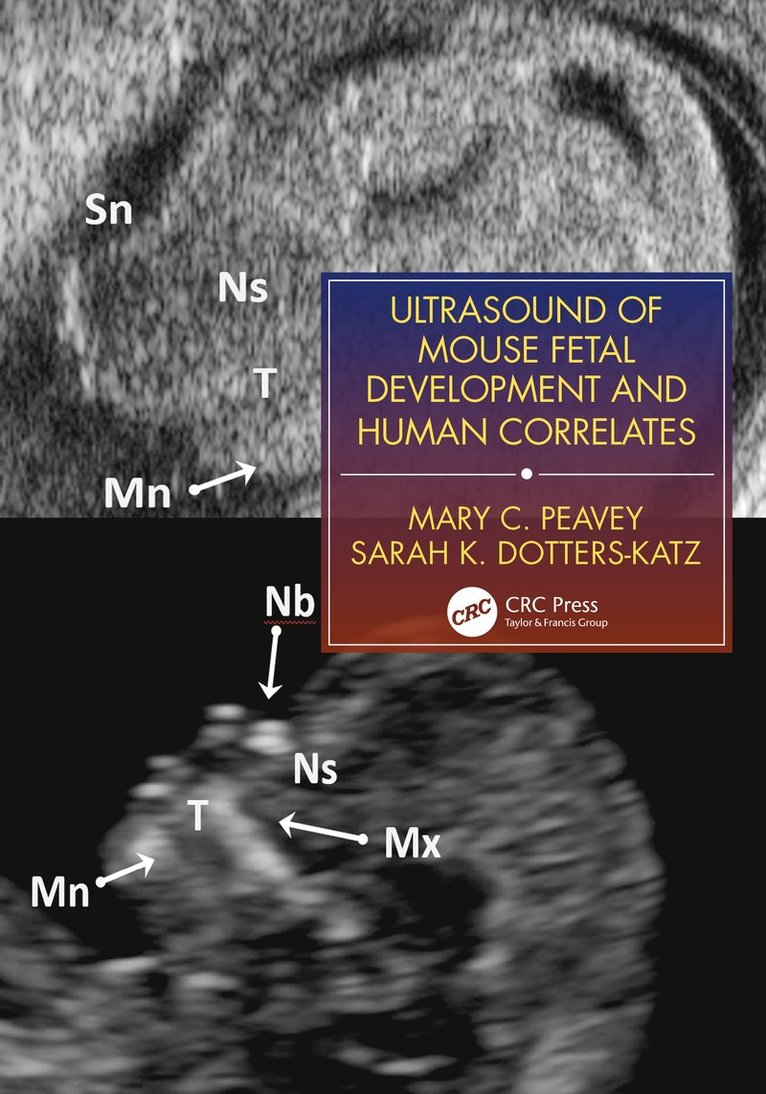 Mary C. Peavey, Sarah K. Dotters-Katz - Ultrasound of Mouse Fetal Development and Human Correlates, Häftad
