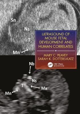 bokomslag Ultrasound of Mouse Fetal Development and Human Correlates