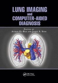 bokomslag Lung Imaging and Computer Aided Diagnosis