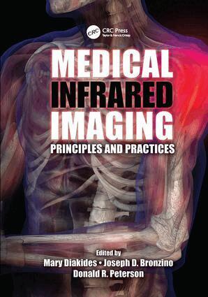 Mary Diakides, Joseph D. Bronzino, Donald R. Peterson - Medical Infrared Imaging, Häftad