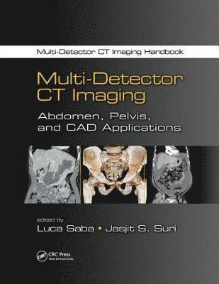 bokomslag Multi-Detector CT Imaging