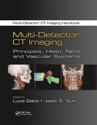 bokomslag Multi-Detector CT Imaging