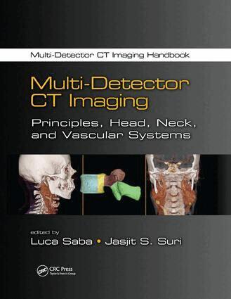 Luca Saba, Jasjit S. Suri - Multi-Detector CT Imaging, Häftad