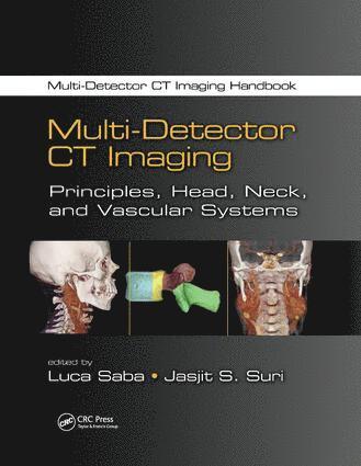 Multi-Detector CT Imaging