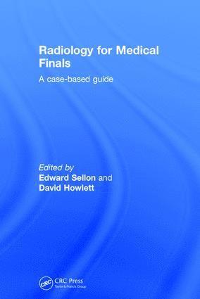 Edward Sellon, David Howlett, UK) Sellon, Edward (BSc (Hons) MBBS MRCS FRCR PgD (SEM) PgD (ESSR) RAMC Consultant Musculoskeletal Radiologist, Oxford University Hospitals; Consultant Military Radiologist, Centre for Defence Radiology, Birmingham - Radiology for Medical Finals, Inbunden