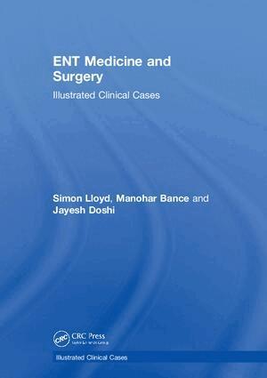 Jayesh Doshi, Manohar Bance, Simon Lloyd - ENT Medicine and Surgery, Inbunden