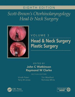 bokomslag Scott-Brown's Otorhinolaryngology and Head and Neck Surgery