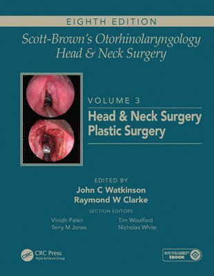 Scott-Brown's Otorhinolaryngology and Head and Neck Surgery 1
