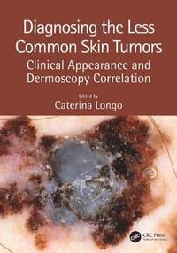 bokomslag Diagnosing the Less Common Skin Tumors