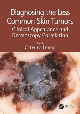Diagnosing the Less Common Skin Tumors 1