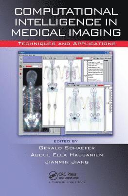 Computational Intelligence in Medical Imaging 1