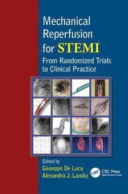 Giuseppe De Luca, Alexandra Lansky, Italy) De Luca, Giuseppe (Eastern Piedmont University, Novara, USA) Lansky, Alexandra (Columbia University Medical Center, Cardiovascular Research Foundation, New York, NY, Giuseppe de Luca - Mechanical Reperfusion for STEMI, Häftad