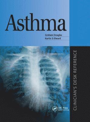 bokomslag Asthma