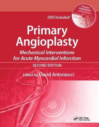 David Antoniucci - Primary Angioplasty, Häftad