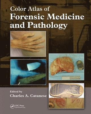 Color Atlas of Forensic Medicine and Pathology 1