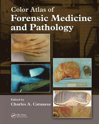 Charles Catanese, Brian Heaton, Charles A Catanese - Color Atlas of Forensic Medicine and Pathology, Häftad