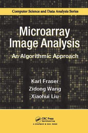 Karl Fraser, Zidong Wang, Xiaohui Liu - Microarray Image Analysis, Häftad