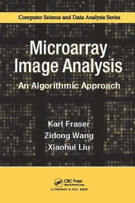 Karl Fraser, Zidong Wang, Xiaohui Liu, UK) Fraser, Karl (Brunel University, Uxbridge, Middlesex, England, UK) Wang, Zidong (Brunel University London, UK) Liu, Xiaohui (Brunel University, Uxbridge, Middlesex, England - Microarray Image Analysis, Häftad