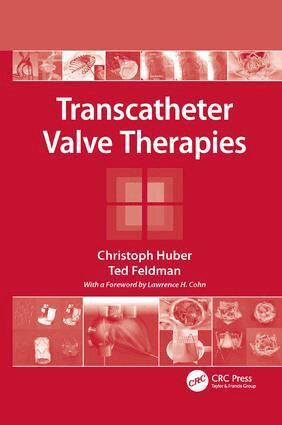 Christoph Huber, Ted Feldman - Transcatheter Valve Therapies, Häftad