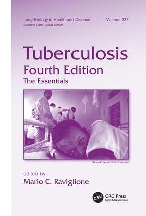 bokomslag Tuberculosis