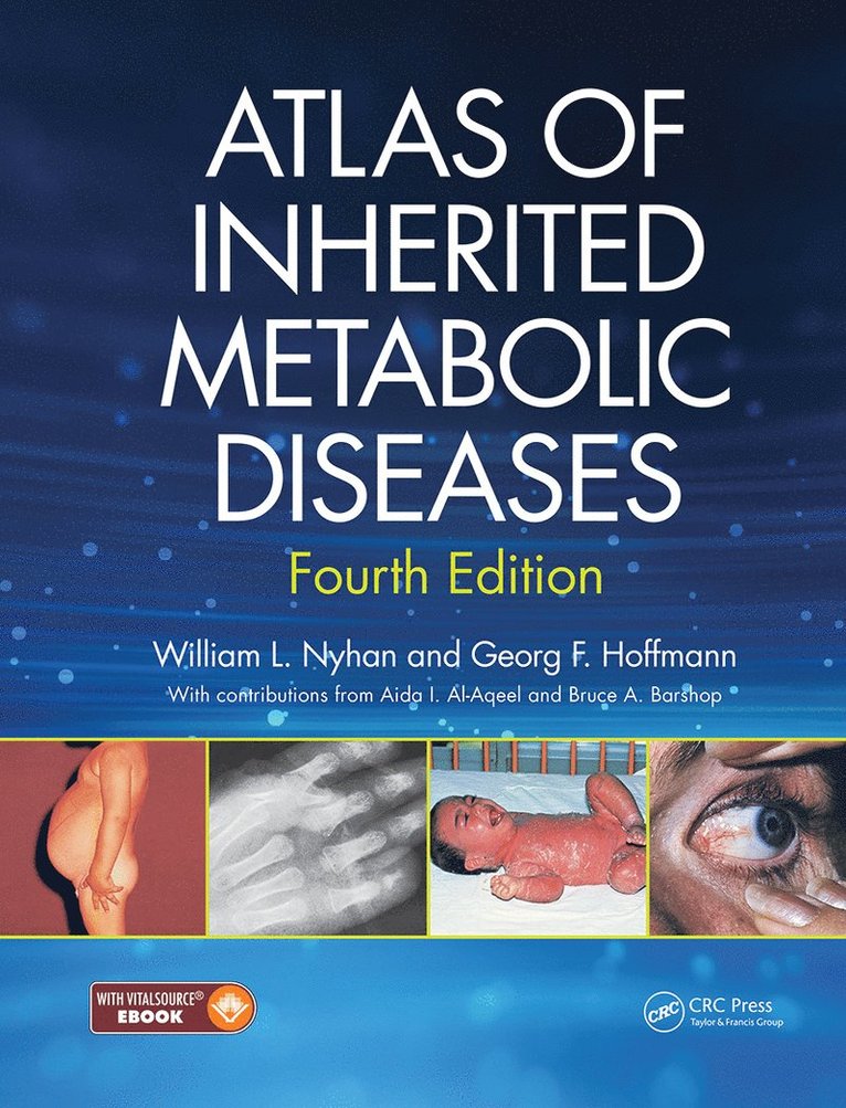 William L Nyhan, Georg F Hoffmann, USA) Nyhan, William L (The William L. Nyhan Biochemical Genetics and Metabolomics Laboratory, UCSD, Germany) Hoffmann, Georg F (Head of the Center of Rare Diseases, University Clinic Heidelberg, William L. Nyhan, Georg F. Hoffmann - Atlas of Inherited Metabolic Diseases, Inbunden